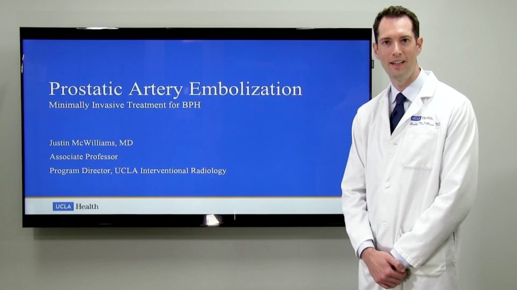 Prostatic Artery Embolization A Non Surgical Treatment For Enlarged Prostate Uclamdchat